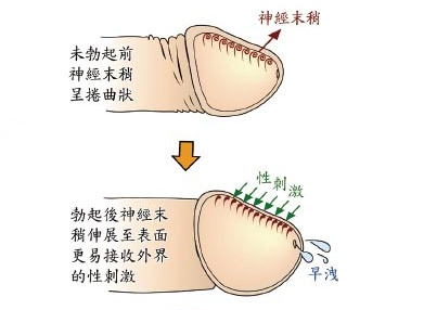 早泄的原因有哪些?