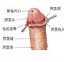 龟头炎的主要危害是什么?