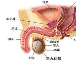 男性尿道炎为什么容易反复?