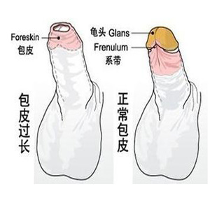 怎样算是包皮过长?对男性有什么危害?